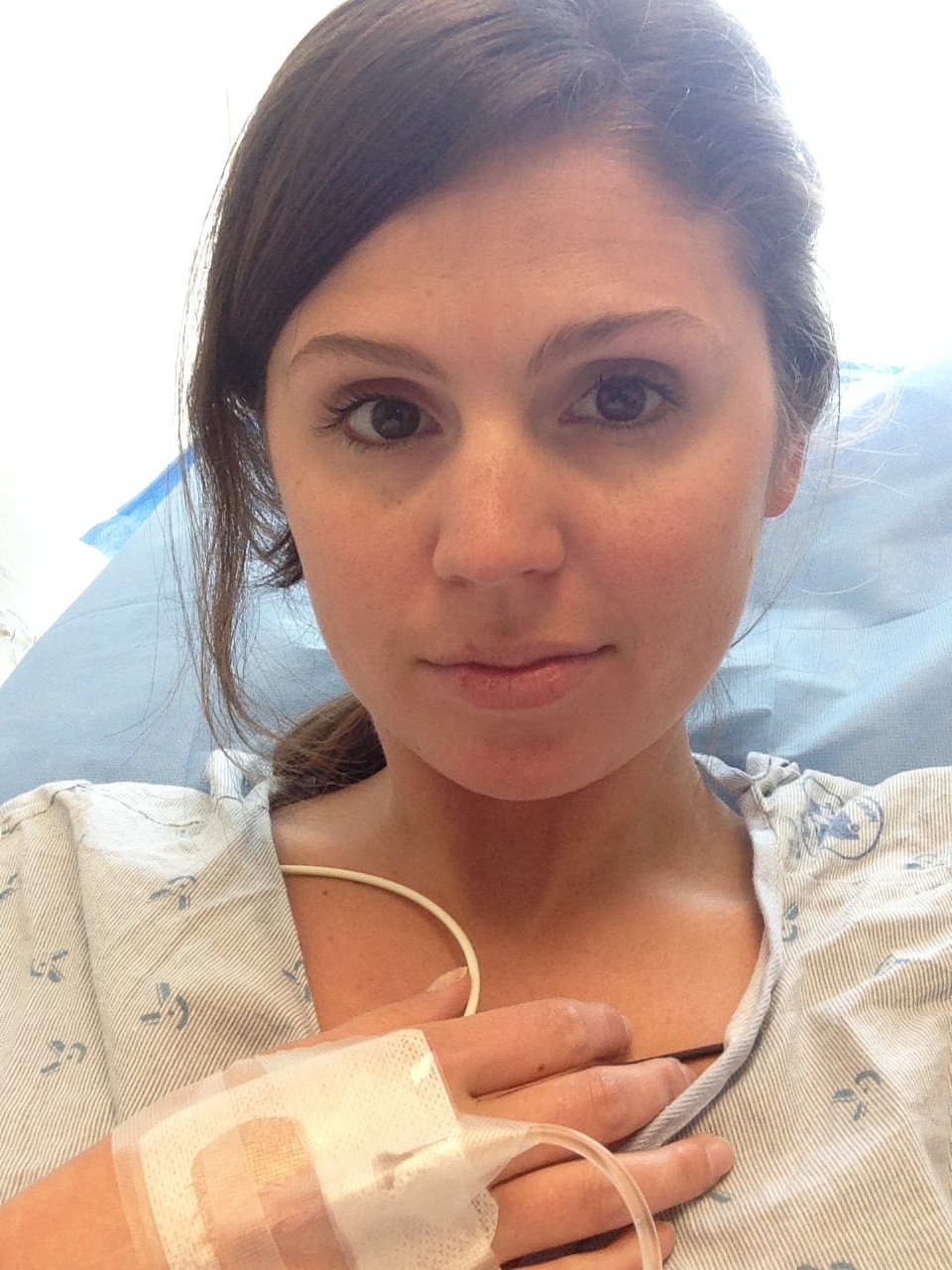 stoma colon ostomy ileostomy ileoscopy hospital procedure IV stomach stephanie hughes stolen colon crohn's disease ulcerative colitis inflammatory bowel disease ibd blog ostomy