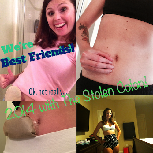 The Stolen Colon ostomy ileostomy urostomy colostomy Crohn's disease ulcerative colitis inflammatory bowel disease ibd colon stephanie hughes blog