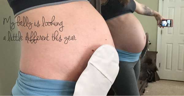 pregnant baby conceive ostomies advice tips tricks stephanie hughes out of the bag colostomy ileostomy crohn's disease ulcerative colitis inflammatory bowel disease ibd ostomy blog stolen colon ileostomy colostomy urostomy second trimester