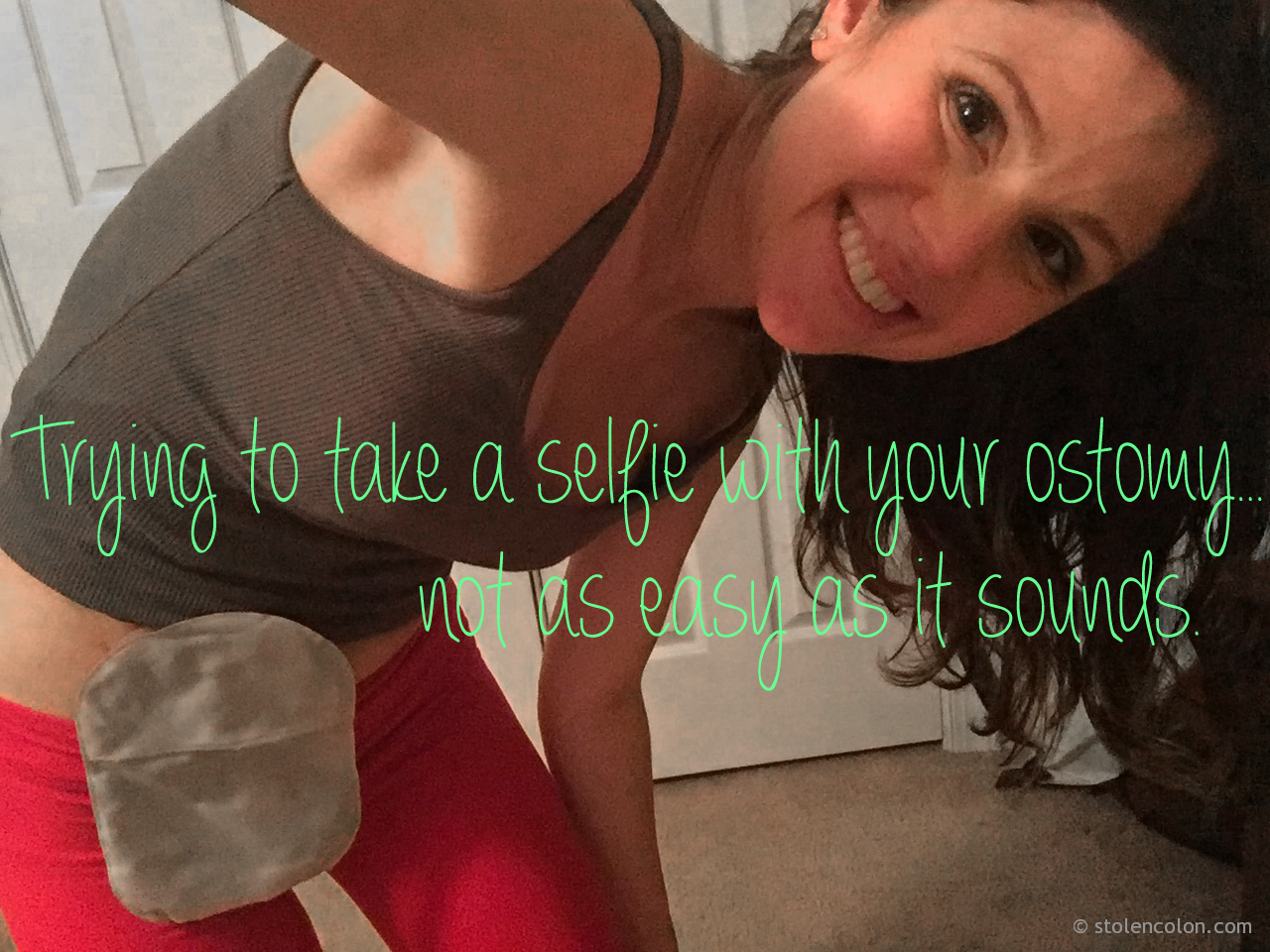 ostomy selfie stephanie hughes stolen colon crohn's disease inflammatory bowel disease