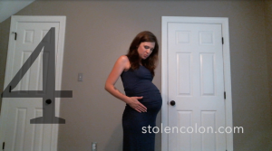 stolen colon ileostomy ostomy fashion dress clothing pregnant