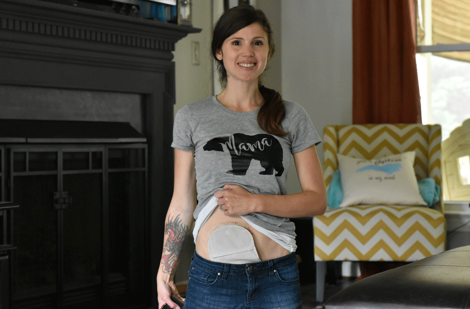 stephanie hughes stolen colon ostomy anniversary inflammatory bowel disease crohn's ulcerative colitis ileostomy ibd
